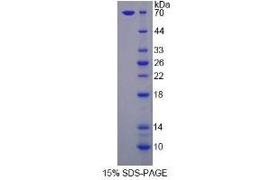 SDS-PAGE analysis of Human LSR Protein. (LSR Protéine)