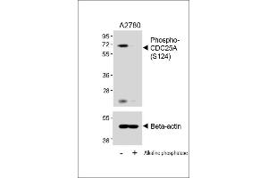 Western blot analysis of lysates from  cell line, untreated or treated with Alkaline phosphatase, 1h, using 459088101 A (upper) or Beta-actin (lower). (CDC25A anticorps  (pSer124))