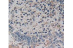 IHC-P analysis of Human Tissue, with DAB staining. (Dermokine anticorps  (AA 27-238))