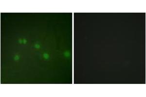 Immunofluorescence analysis of HuvEc cells, using COT2 Antibody. (Grr1p anticorps  (AA 1-50))