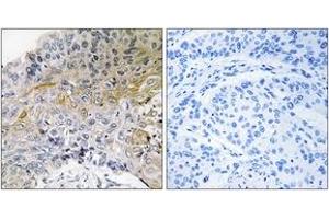 Immunohistochemistry (IHC) image for anti-Breast Cancer Anti-Estrogen Resistance 1 (BCAR1) (AA 376-425) antibody (ABIN2888602) (BCAR1 anticorps  (AA 376-425))