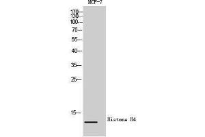 Western Blotting (WB) image for anti-Histone H4 (Lys310) antibody (ABIN3185040) (Histone H4 anticorps  (Lys310))