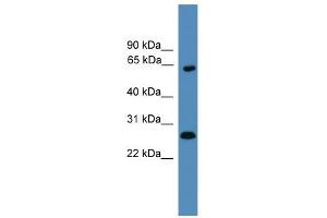 WB Suggested Anti-HMGB1 Antibody Titration: 0. (HMGB1 anticorps  (Middle Region))