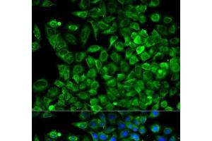 Immunofluorescence analysis of A549 cells using ALDOA Polyclonal Antibody (ALDOA anticorps)
