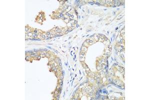 Immunohistochemistry of paraffin-embedded human prostate using CBL antibody. (CBL anticorps)