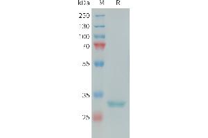 Human Protein, His Tag on SDS-PAGE under reducing condition. (FCN1 Protein (AA 30-326) (His tag))