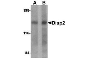 Image no. 1 for anti-Dispatched Homolog 2 (DISP2) (C-Term) antibody (ABIN341692) (DISP2 anticorps  (C-Term))