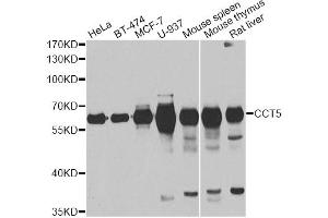 Western blot analysis of extracts of various cell lines, using CCT5 antibody (ABIN5973932) at 1/1000 dilution. (CCT5 anticorps)