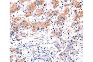 Immunohistochemistry (IHC) image for anti-C-Type Lectin Domain Family 4, Member D (CLEC4D) (AA 39-215) antibody (ABIN6219759) (CLEC4D anticorps  (AA 39-215))