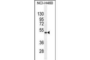 Western blot analysis in NCI-H460 cell line lysates (35ug/lane). (FNDC8 anticorps  (AA 204-232))