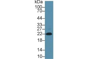 Western Blot; Sample: Rat Heart; Primary Ab: 1µg/ml Mouse Anti-Rabbit NT-ProBNP Antibody Second Ab: 0. (NT-ProBNP anticorps)