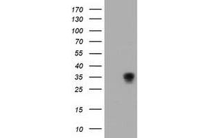 HEK293T cells were transfected with the pCMV6-ENTRY control (Left lane) or pCMV6-ENTRY ACY3 (Right lane) cDNA for 48 hrs and lysed. (Aminoacylase 3 anticorps)