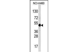 Western blot analysis of TFAP2A Antibody in NCI-H460 cell line lysates (35ug/lane) (TFAP2A anticorps  (C-Term))