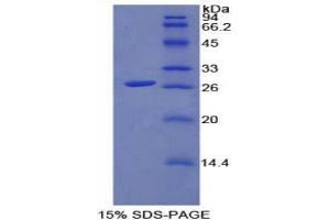 SDS-PAGE analysis of Rat FGFRL1 Protein. (FGFRL1 Protéine)