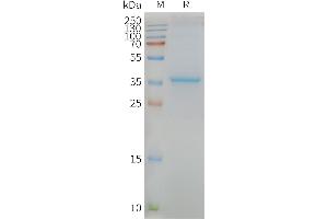 Human -Nanodisc, Flag Tag on SDS-PAGE (MLC1 Protéine)