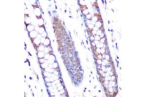 Immunohistochemistry of paraffin-embedded human colon using SKP2 Rabbit mAb (ABIN1680764, ABIN3018459, ABIN3018460 and ABIN7101615) at dilution of 1:100 (40x lens). (SKP2 anticorps)