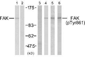 Western blot analysis using FAK (Ab-861) antibody (#B7082, Line 1 and 2) and FAK (phospho-Tyr861) antibody (#11059, Line 3, 4, 5 and 6). (FAK anticorps  (Tyr861))