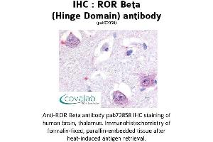 Image no. 1 for anti-RAR-Related Orphan Receptor B (RORB) antibody (ABIN1738925) (RORB anticorps)