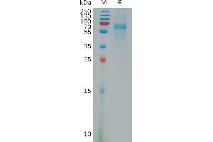 Human Protein, His Tag on SDS-PAGE under reducing condition. (VPS4A Protein (AA 1-437) (His tag))