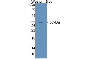 Western blot analysis of the recombinant protein. (TSSK1 anticorps  (AA 57-314))