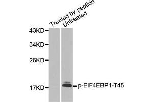 Western Blotting (WB) image for anti-Eukaryotic Translation Initiation Factor 4E Binding Protein 1 (EIF4EBP1) (pThr45) antibody (ABIN1870151) (eIF4EBP1 anticorps  (pThr45))