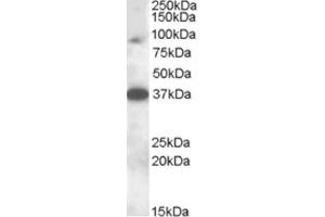 Western Blotting (WB) image for anti-Membrane-Associated Ring Finger (C3HC4) 10, E3 Ubiquitin Protein Ligase (MARCH10) (Internal Region) antibody (ABIN2466780) (MARCH10 anticorps  (Internal Region))