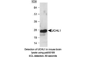 Image no. 1 for anti-Ubiquitin Carboxyl-terminal Esterase L1 (Ubiquitin Thiolesterase) (UCHL1) (AA 100-200) antibody (ABIN363498) (UCHL1 anticorps  (AA 100-200))