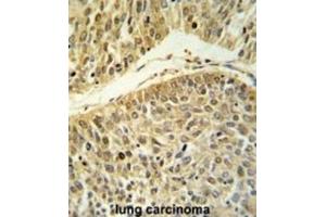 Immunohistochemistry (IHC) image for anti-Arginine-Glutamic Acid Dipeptide (RE) Repeats (RERE) antibody (ABIN3004391) (RERE anticorps)