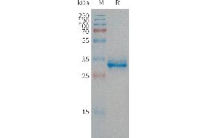 Human CGRP Protein, hFc Tag on SDS-PAGE under reducing condition. (CGRP Protein (AA 83-119) (Fc Tag))