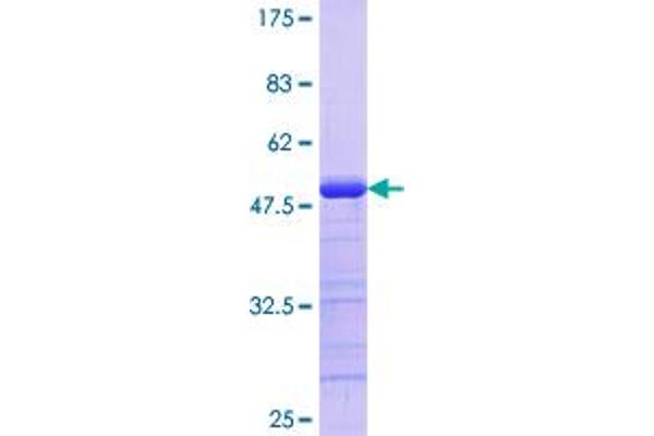 STK3 Protein (AA 311-431) (GST tag)