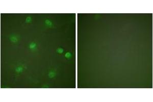 Immunofluorescence analysis of HeLa cells, using MEF2A (Ab-408) Antibody. (MEF2A anticorps  (AA 374-423))