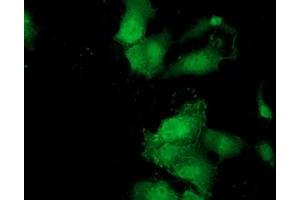 Anti-MOBKL2B mouse monoclonal antibody (ABIN2453315) immunofluorescent staining of COS7 cells transiently transfected by pCMV6-ENTRY MOBKL2B (RC205977). (MOBKL2B anticorps)