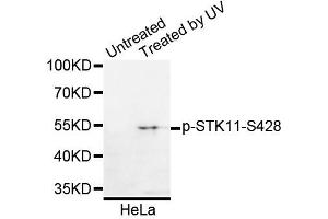 Western blot analysis of extracts of HeLa cells, using Phospho-STK11-S428 antibody. (LKB1 anticorps  (pSer428))