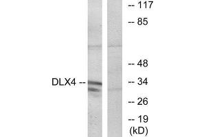 Western Blotting (WB) image for anti-Distal-Less Homeobox 4 (DLX4) (Internal Region) antibody (ABIN1849866) (DLX4 anticorps  (Internal Region))
