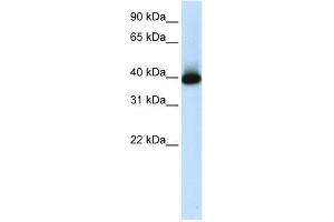 WB Suggested Anti-GSH2 Antibody Titration:  1. (GSX2 anticorps  (C-Term))