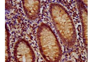 IHC image of ABIN7159682 diluted at 1:700 and staining in paraffin-embedded human appendix tissue performed on a Leica BondTM system. (RFX1 anticorps  (AA 36-133))