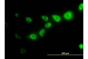 Image no. 2 for anti-Calpain, Small Subunit 1 (CAPNS1) (AA 172-260) antibody (ABIN598500) (Calpain S1 anticorps  (AA 172-260))