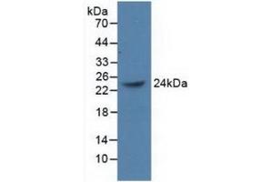 Detection of Recombinant PCGF4, Human using Polyclonal Antibody to Polycomb Group Ring Finger Protein 4 (PCGF4) (BMI1 anticorps  (AA 152-289))