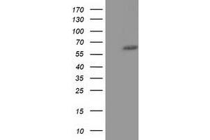 HEK293T cells were transfected with the pCMV6-ENTRY control (Left lane) or pCMV6-ENTRY KLHL2 (Right lane) cDNA for 48 hrs and lysed. (KLHL2 anticorps  (AA 1-100, AA 494-593))