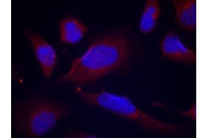 Immunofluorescence staining of methanol-fixed HeLa cells using Phospho-NOS3-S1177 antibody (ABIN2988223). (ENOS anticorps  (pSer1177))