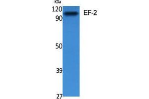 Western Blot (WB) analysis of specific cells using EF-2 Polyclonal Antibody. (EEF2 anticorps  (Ser311))