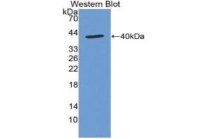 Western blot analysis of the recombinant protein. (CXCL12 anticorps  (AA 21-89))