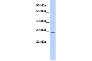 TFPI2 antibody used at 1 ug/ml to detect target protein. (TFPI2 anticorps  (Middle Region))