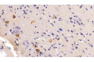 Detection of NOS1 in Mouse Cerebrum Tissue using Polyclonal Antibody to Nitric Oxide Synthase 1, Neuronal (NOS1) (NOS1 anticorps  (AA 53-247))