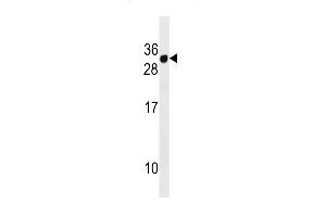 Western blot analysis in MDA-MB453 cell line lysates (35ug/lane). (CD300E anticorps  (AA 48-76))