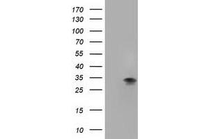 Western Blotting (WB) image for anti-Four and A Half LIM Domains 1 (FHL1) antibody (ABIN1500974) (FHL1 anticorps)