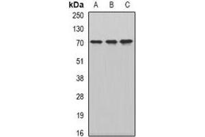Western blot analysis of CKAP4 expression in HepG2 (A), MCF7 (B), mouse testis (C) whole cell lysates. (CKAP4 anticorps)