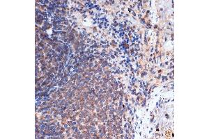 Immunohistochemistry of paraffin-embedded rat spleen using FNTB Rabbit mAb (ABIN1680761, ABIN3016316, ABIN3016317 and ABIN7101479) at dilution of 1:100 (40x lens). (FNTB anticorps)