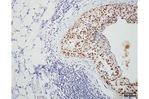 Immunohistochemistry analysis using Rat Anti-HSF1 Monoclonal Antibody, Clone 4B4 . (HSF1 anticorps  (AA 425-439) (FITC))