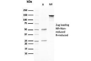 SDS-PAGE Analysis Purified CD80 Mouse Monoclonal Antibody (C80/2776). (CD80 anticorps  (AA 35-142))